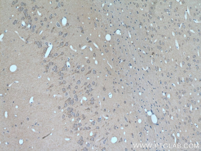 GALNT9 Antibody in Immunohistochemistry (Paraffin) (IHC (P))