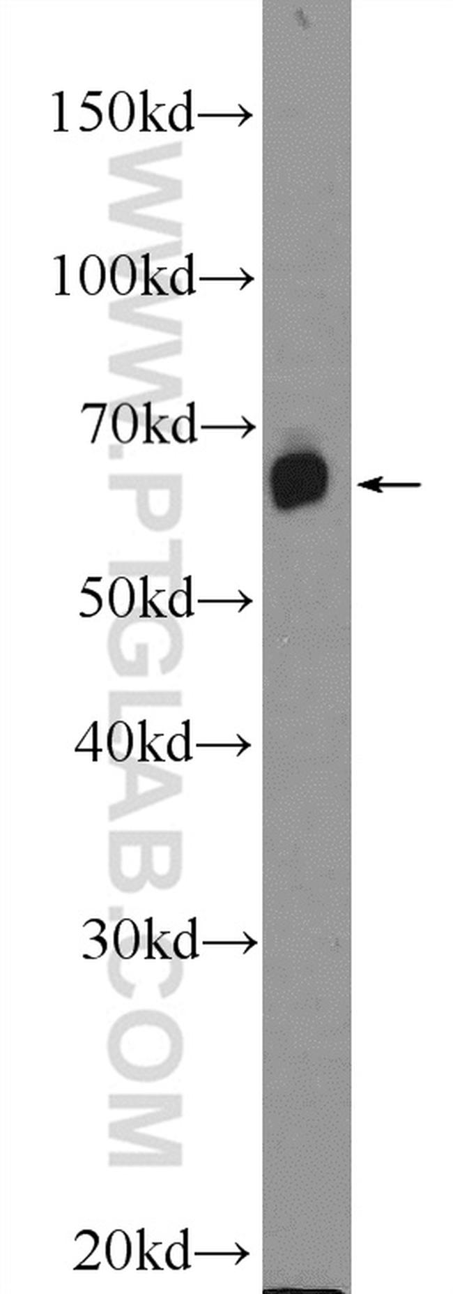 GALNT9 Antibody in Western Blot (WB)