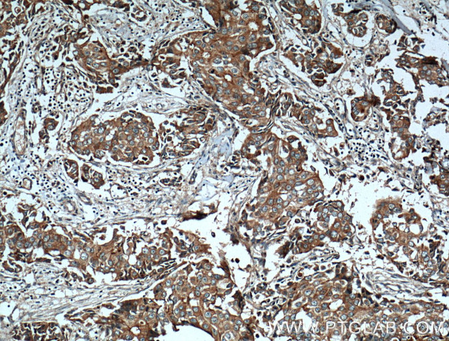 c-SRC Antibody in Immunohistochemistry (Paraffin) (IHC (P))