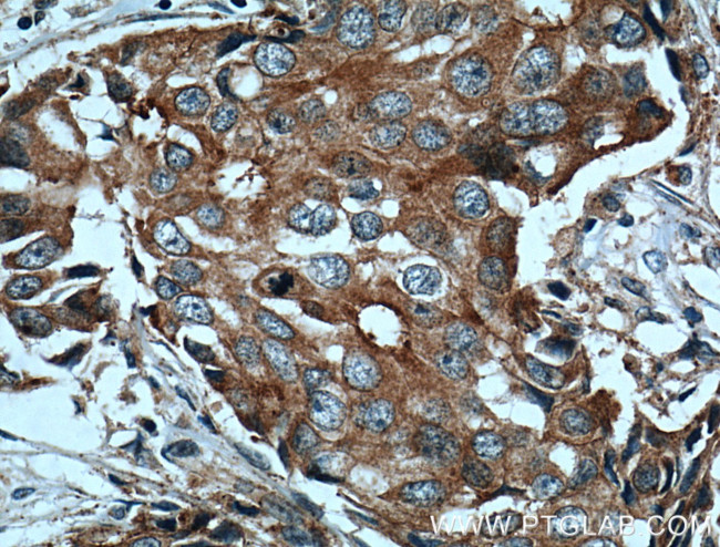 c-SRC Antibody in Immunohistochemistry (Paraffin) (IHC (P))