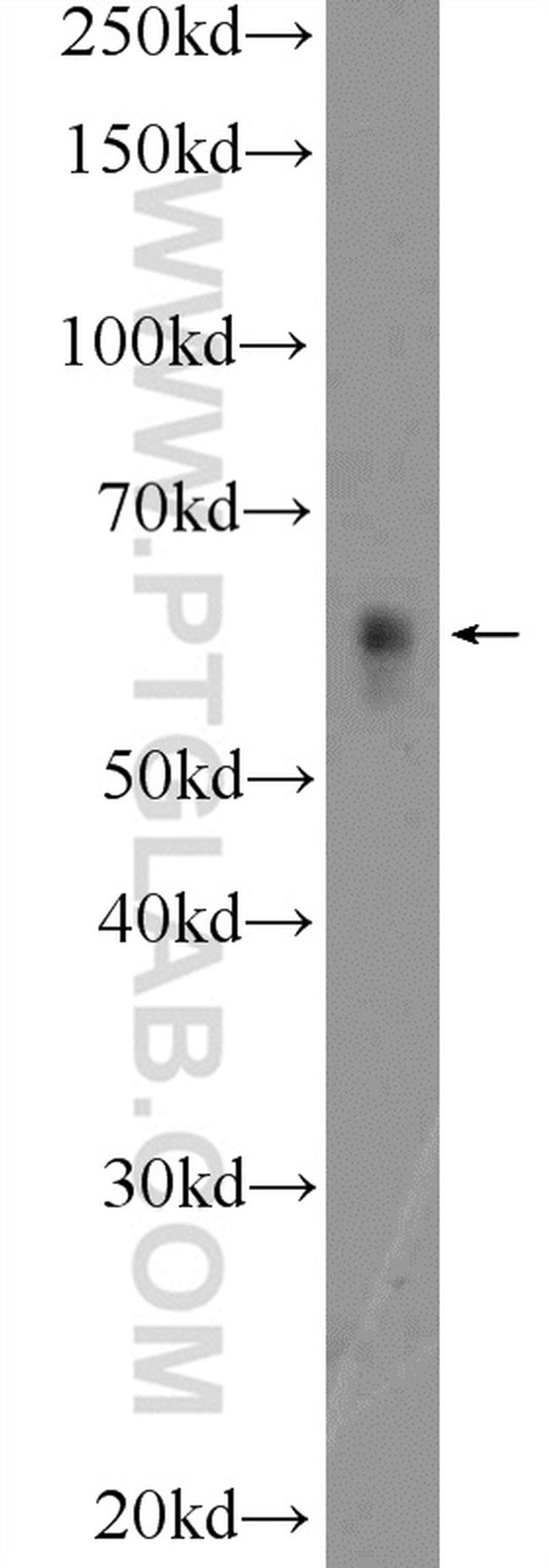 c-SRC Antibody in Western Blot (WB)