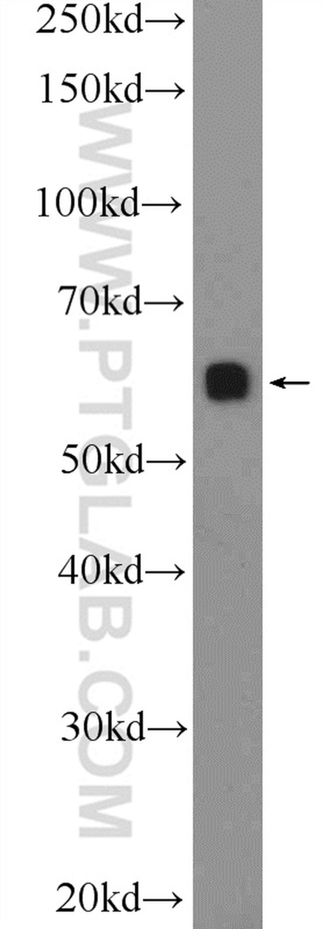 c-SRC Antibody in Western Blot (WB)