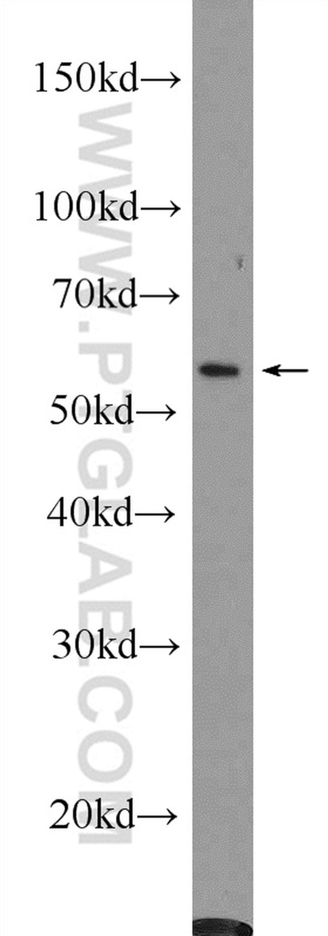 c-SRC Antibody in Western Blot (WB)