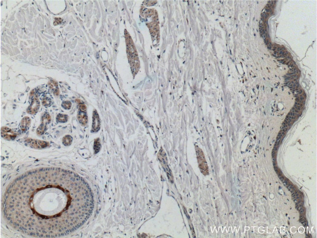 JPH1 Antibody in Immunohistochemistry (Paraffin) (IHC (P))