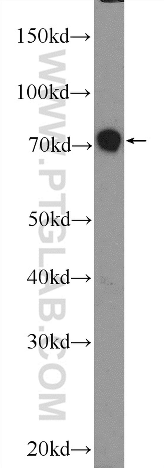 JPH1 Antibody in Western Blot (WB)