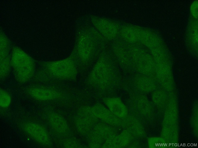 FMN1 Antibody in Immunocytochemistry (ICC/IF)