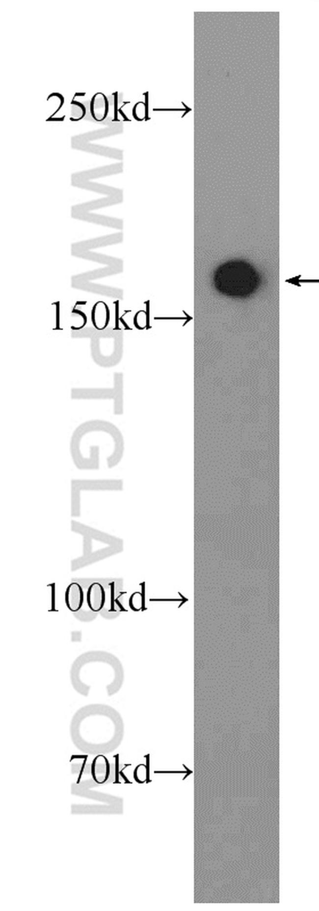 FMN1 Antibody in Western Blot (WB)