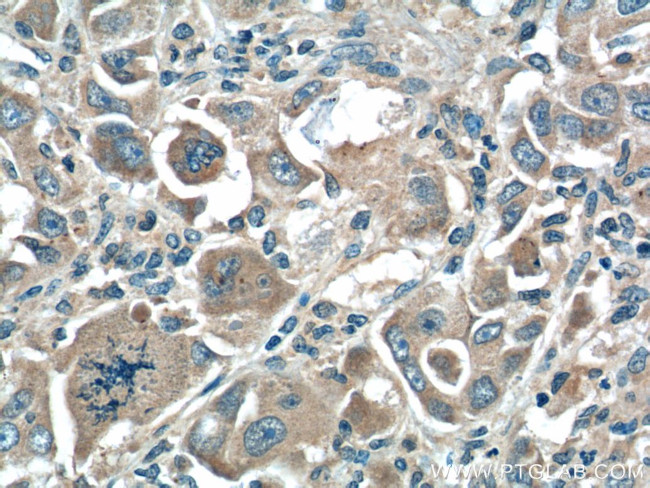 XBP1 Antibody in Immunohistochemistry (Paraffin) (IHC (P))