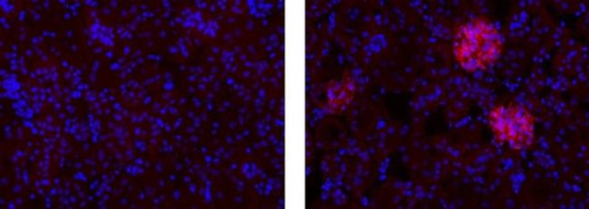 Rat IgG (H+L) Secondary Antibody in Immunohistochemistry (Frozen) (IHC (F))