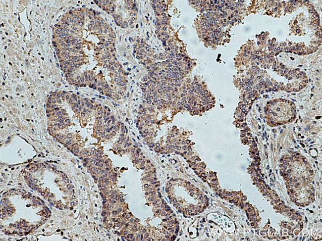 KIF14 Antibody in Immunohistochemistry (Paraffin) (IHC (P))