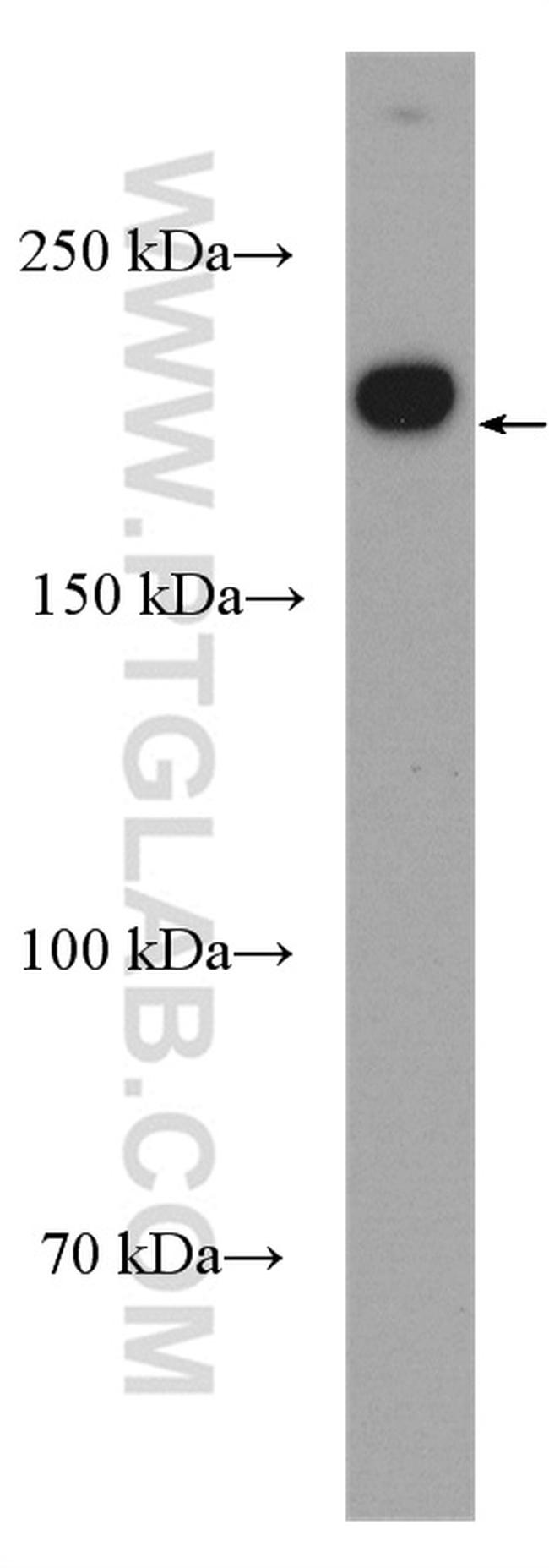 KIF14 Antibody in Western Blot (WB)