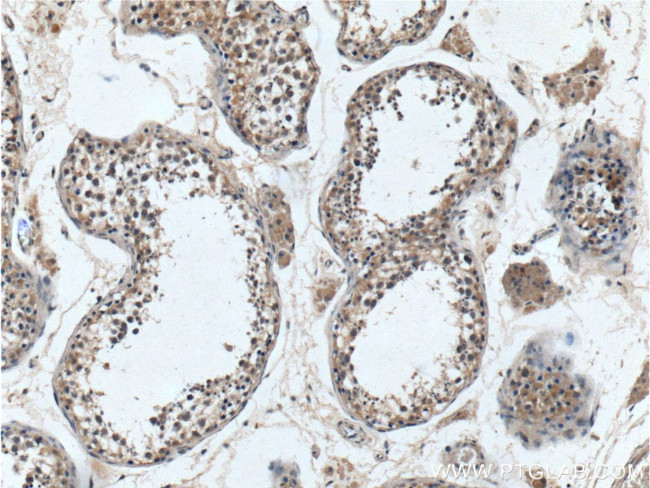 SRD5A1 Antibody in Immunohistochemistry (Paraffin) (IHC (P))