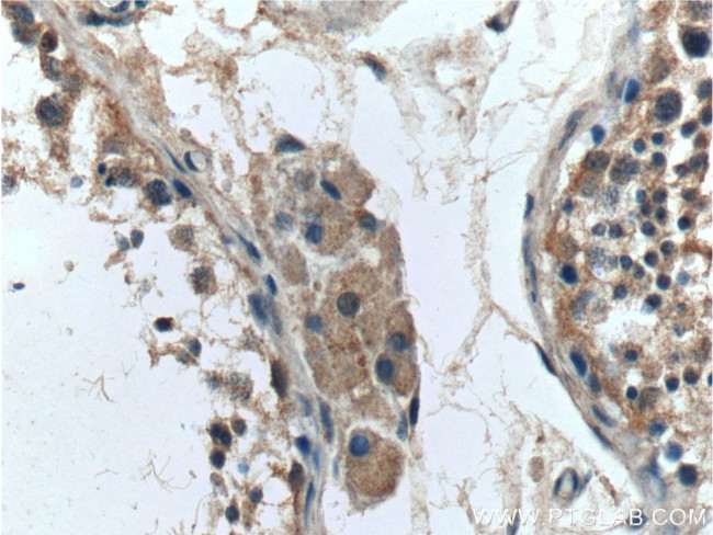 SRD5A1 Antibody in Immunohistochemistry (Paraffin) (IHC (P))