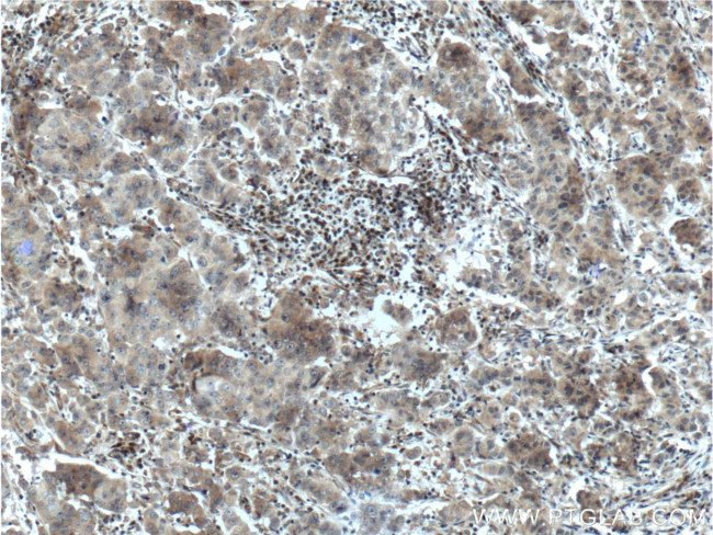 SRD5A1 Antibody in Immunohistochemistry (Paraffin) (IHC (P))