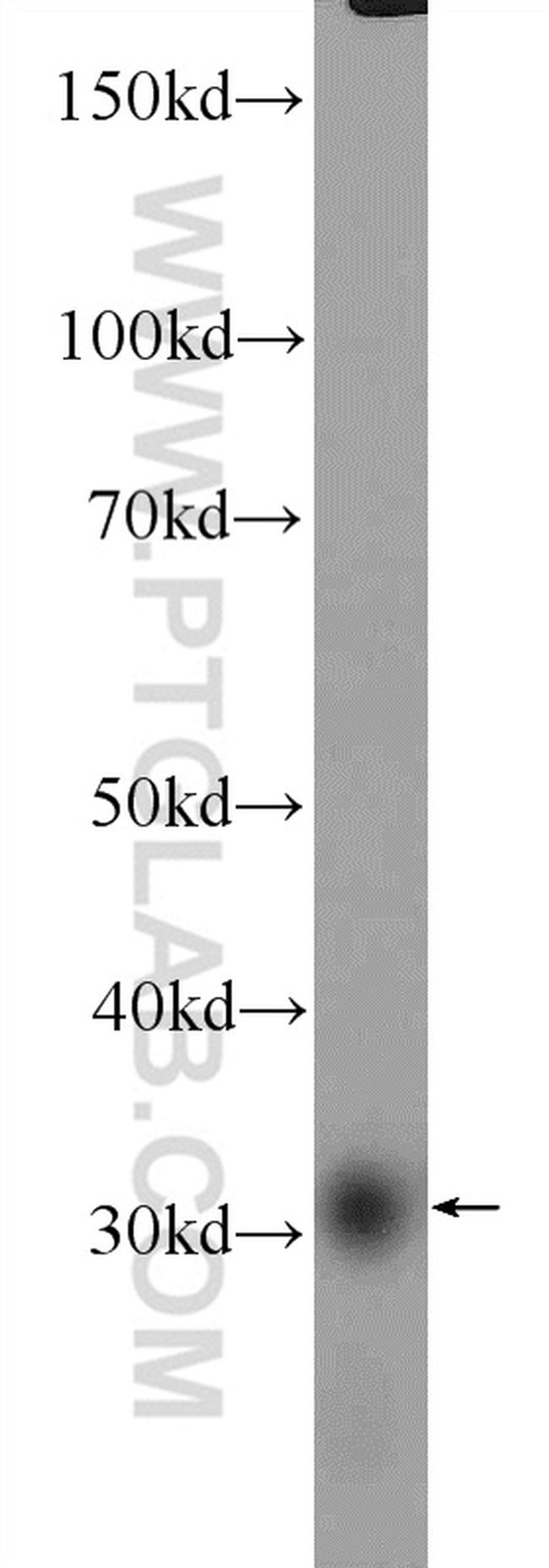 SRD5A1 Antibody in Western Blot (WB)