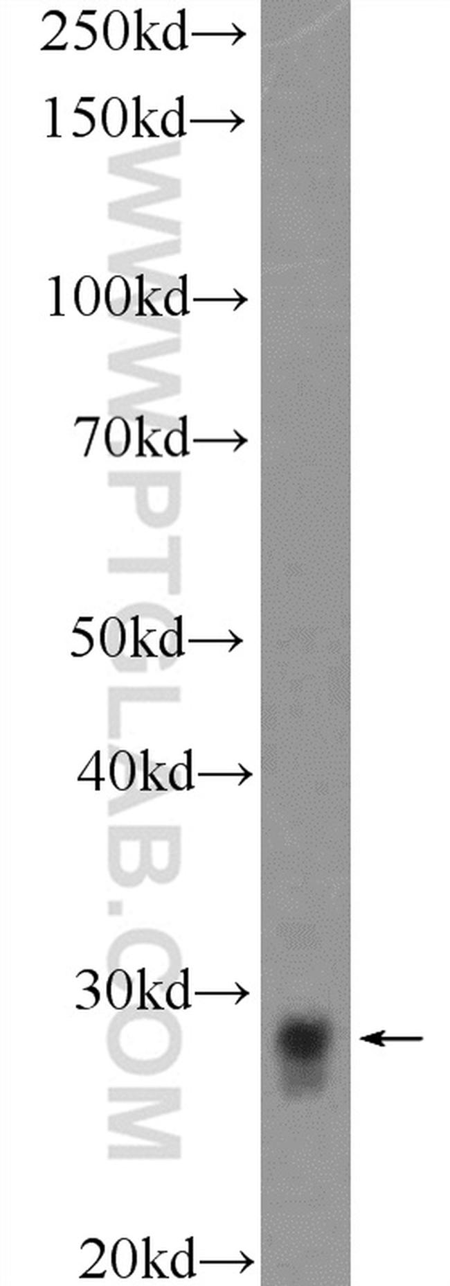 SRD5A1 Antibody in Western Blot (WB)