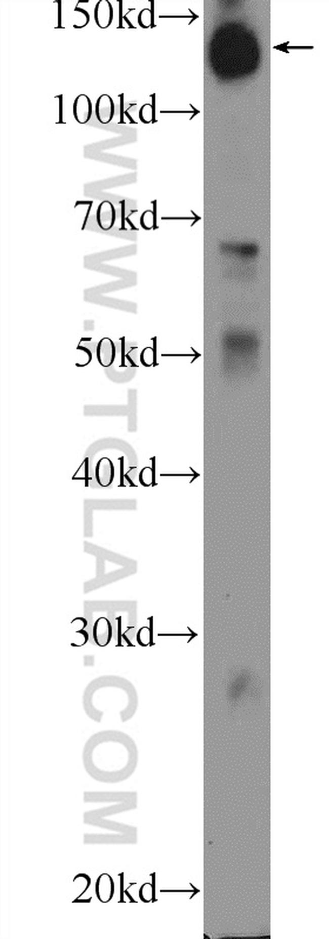 HISPPD1 Antibody in Western Blot (WB)