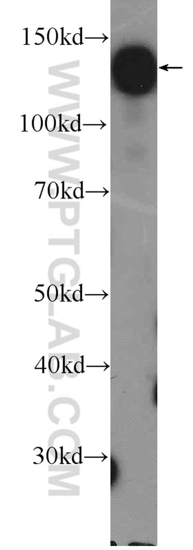 HISPPD1 Antibody in Western Blot (WB)