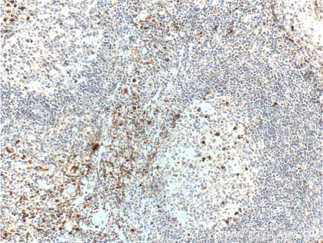 LRRC32 Antibody in Immunohistochemistry (Paraffin) (IHC (P))