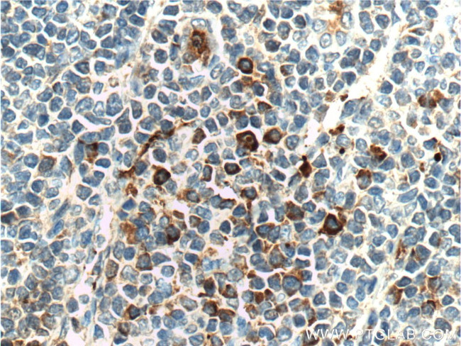 LRRC32 Antibody in Immunohistochemistry (Paraffin) (IHC (P))
