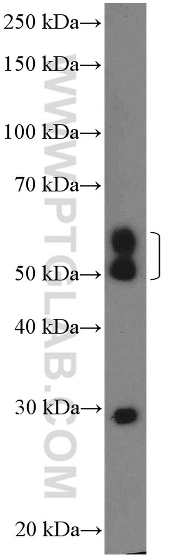 CHST2 Antibody in Western Blot (WB)