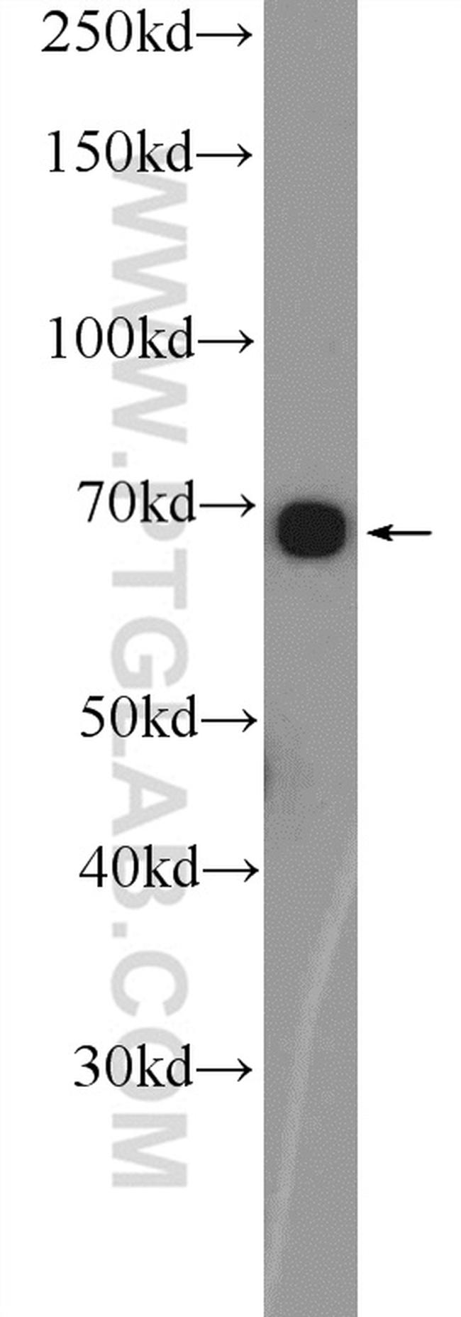 C2orf37 Antibody in Western Blot (WB)