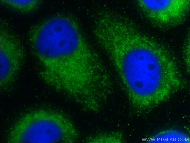 C9orf9 Antibody in Immunocytochemistry (ICC/IF)