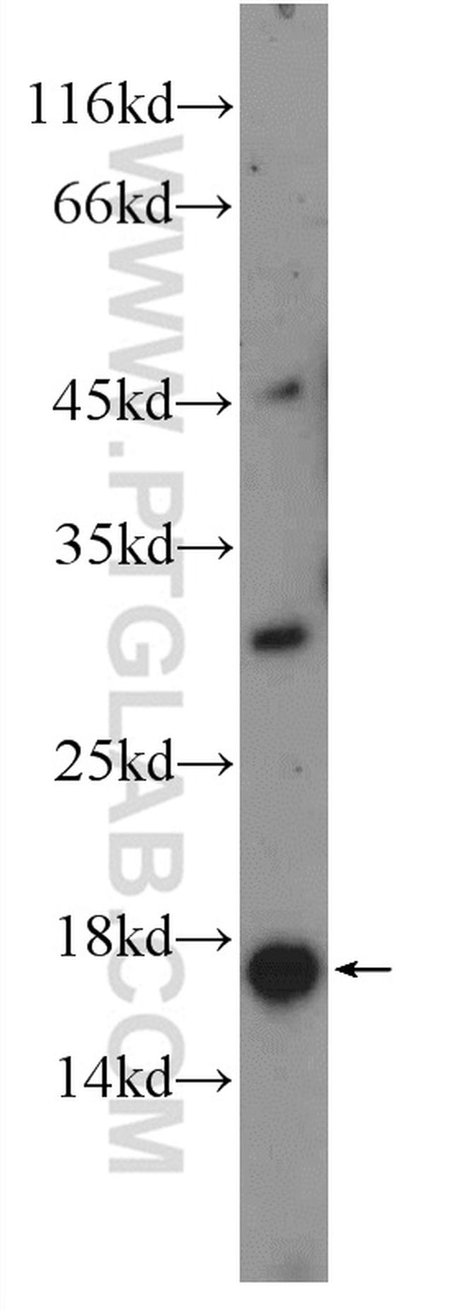 C9orf9 Antibody in Western Blot (WB)