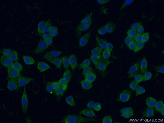 IGSF2 Antibody in Immunocytochemistry (ICC/IF)