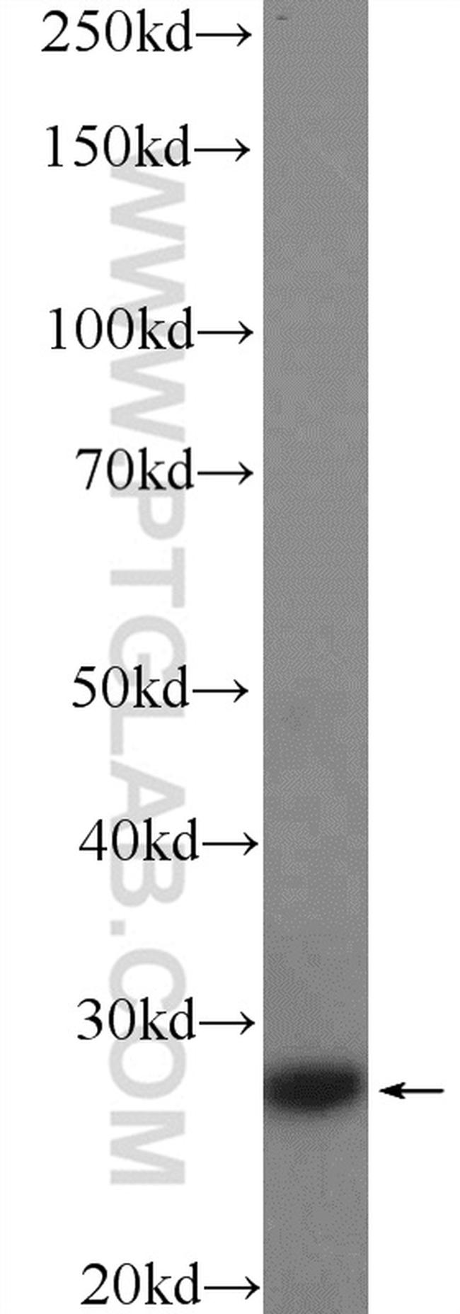 CFD Antibody in Western Blot (WB)