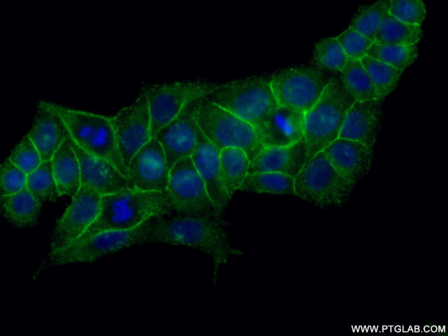 MSN Antibody in Immunocytochemistry (ICC/IF)