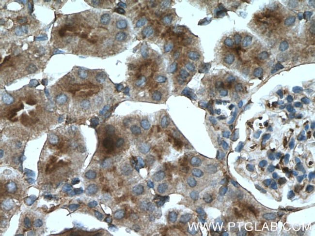 MSN Antibody in Immunohistochemistry (Paraffin) (IHC (P))