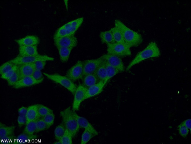 Ezrin Antibody in Immunocytochemistry (ICC/IF)