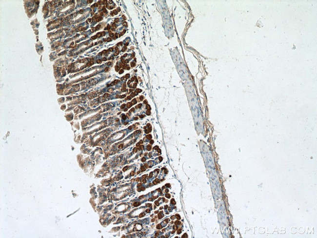 Ezrin Antibody in Immunohistochemistry (Paraffin) (IHC (P))