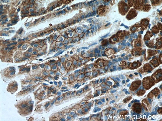 Ezrin Antibody in Immunohistochemistry (Paraffin) (IHC (P))