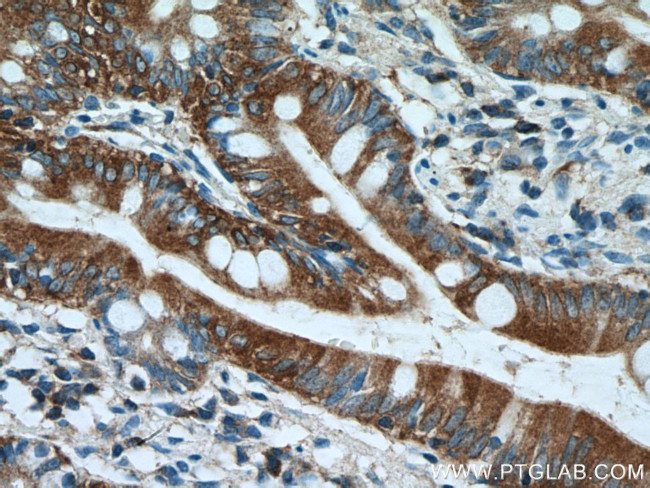 Ezrin Antibody in Immunohistochemistry (Paraffin) (IHC (P))