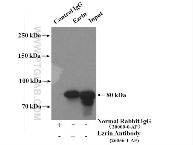 Ezrin Antibody in Immunoprecipitation (IP)