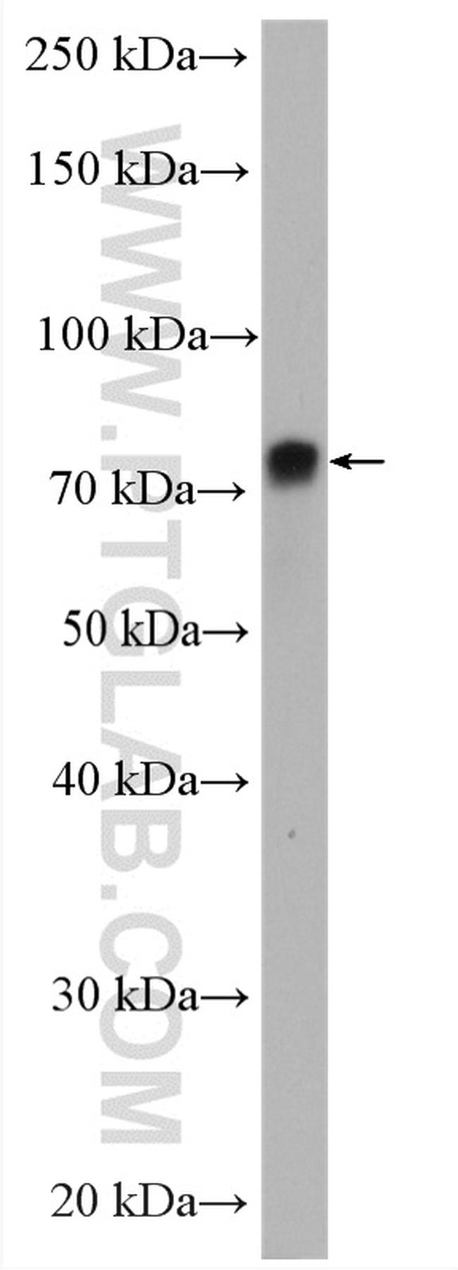 Ezrin Antibody in Western Blot (WB)