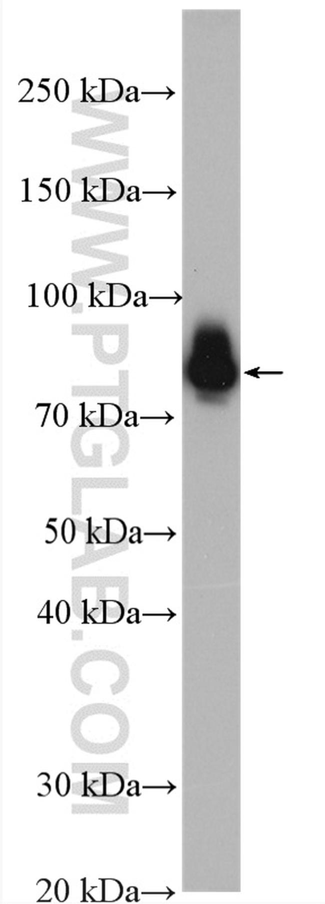 Ezrin Antibody in Western Blot (WB)