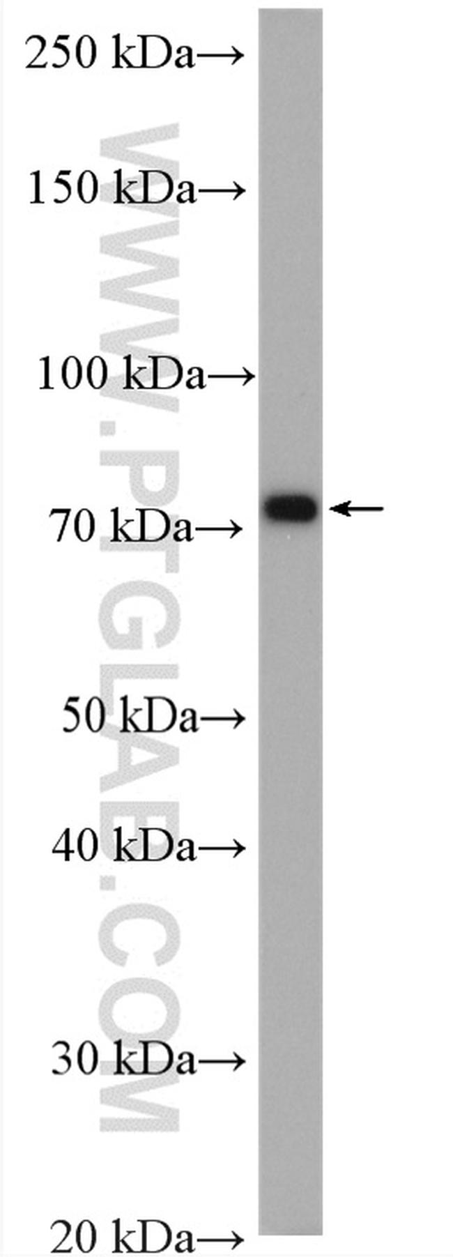 Ezrin Antibody in Western Blot (WB)