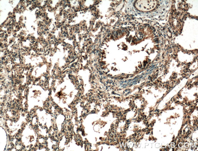 RASIP1 Antibody in Immunohistochemistry (Paraffin) (IHC (P))