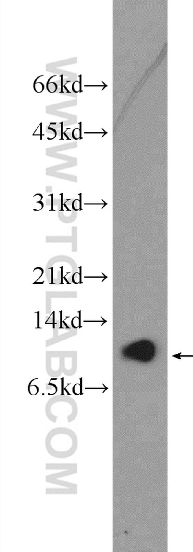 C16orf61 Antibody in Western Blot (WB)