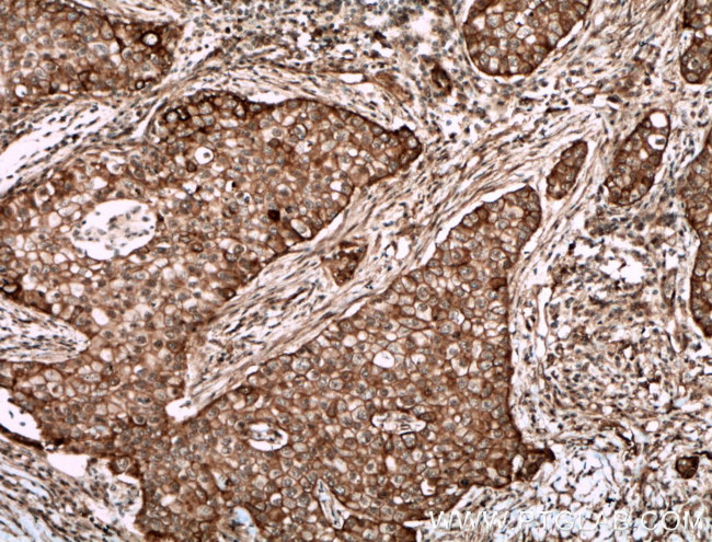 ECE1 Antibody in Immunohistochemistry (Paraffin) (IHC (P))