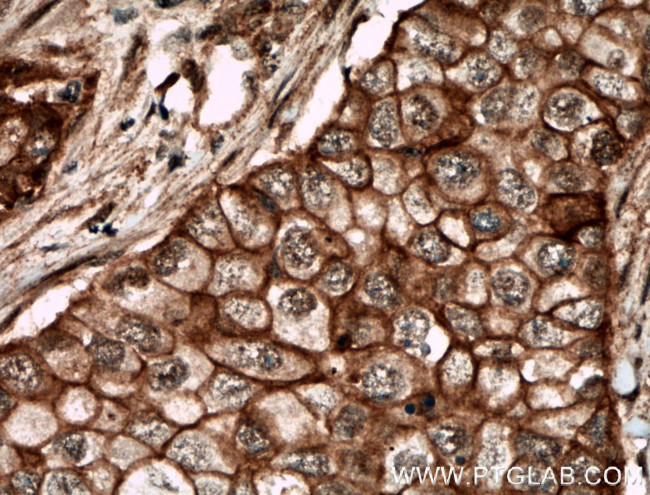 ECE1 Antibody in Immunohistochemistry (Paraffin) (IHC (P))