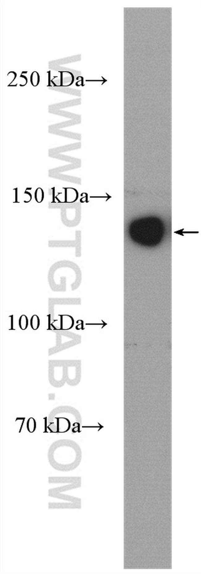 ECE1 Antibody in Western Blot (WB)