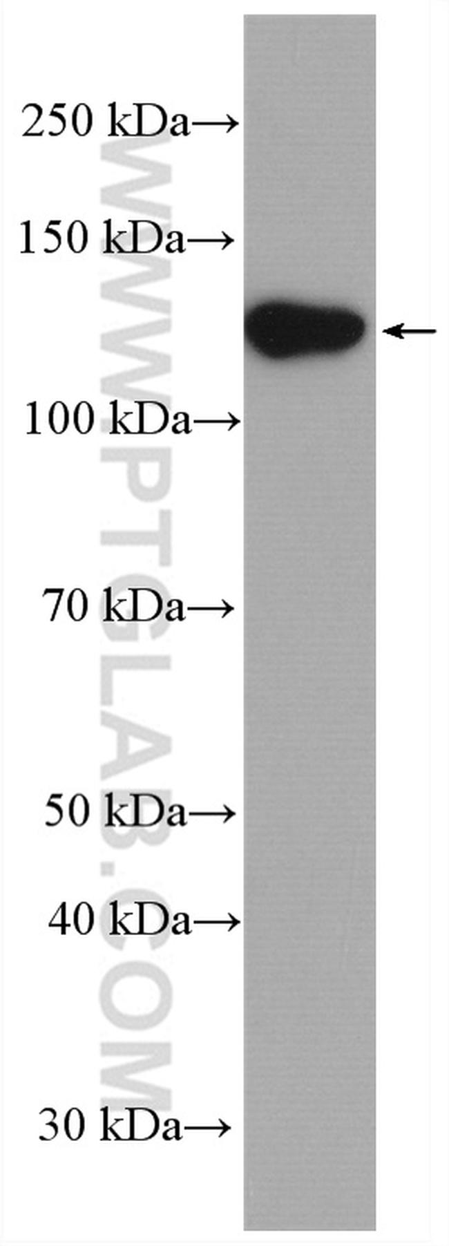 ECE1 Antibody in Western Blot (WB)