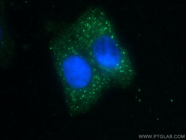 ZNF184 Antibody in Immunocytochemistry (ICC/IF)