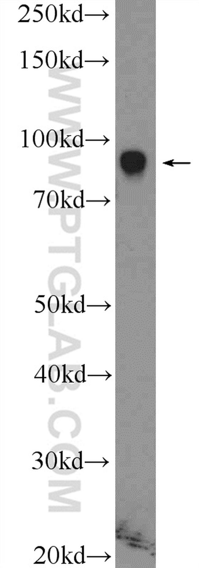 ZNF184 Antibody in Western Blot (WB)