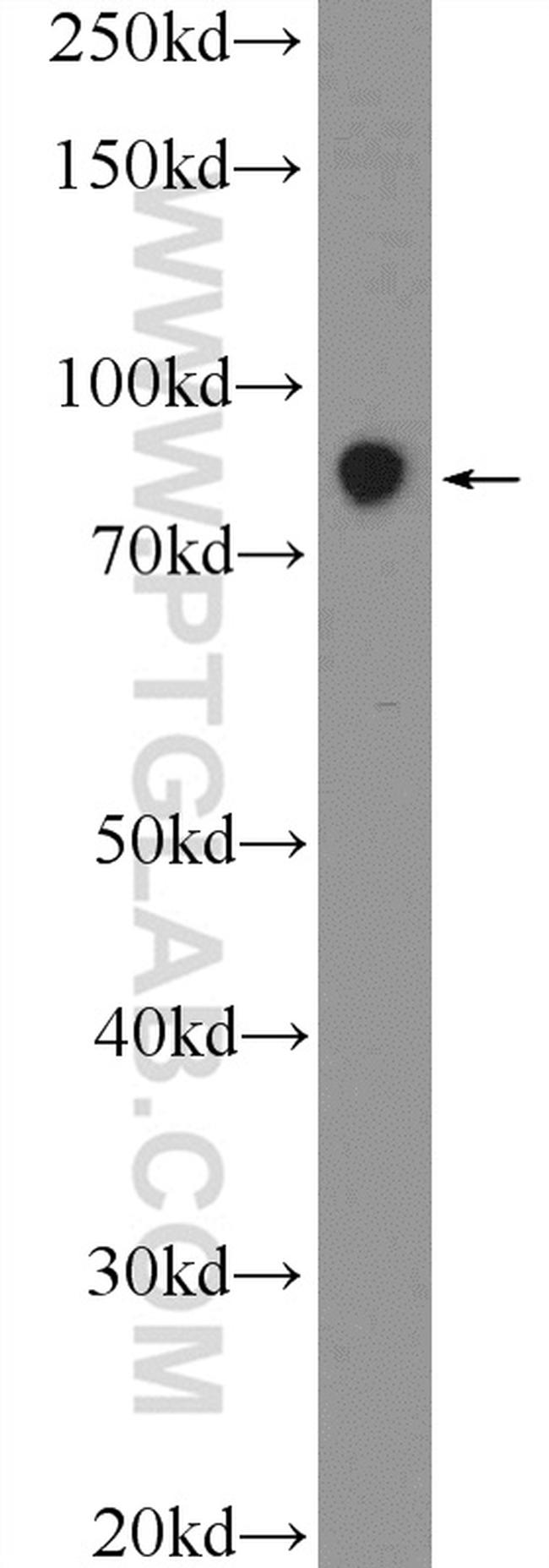 ZNF184 Antibody in Western Blot (WB)