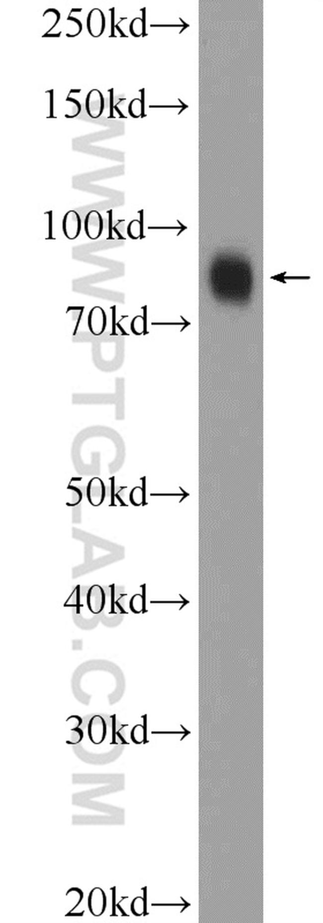 ZNF184 Antibody in Western Blot (WB)